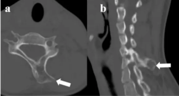 Figure 2 a, b. Axial (a) and sagittal (b) CT images: 