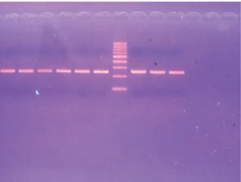 Figure 1. Image of the DNA bands cut with the marker on the UV illuminator.