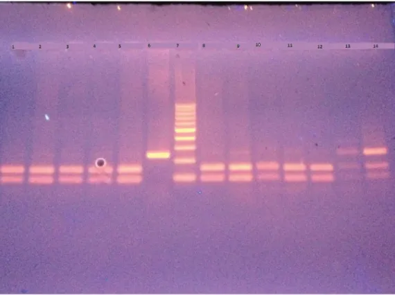 Figure 2. Image of the PCR gel electrophoresis for the LCS6 polymorphism T &gt; G change in the 3’ UTR of the KRAS gene.