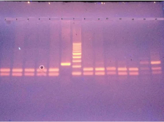 Figure 2. Image of the PCR gel electrophoresis for the LCS6 polymorphism T > G change in the 3’ UTR of the KRAS gene.