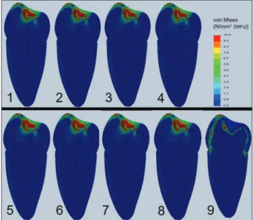 Table 2: Mean elastic modulus values of root dentine  obtained at totally 90 µm (mean±SE)
