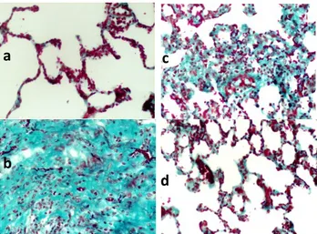 Figure  1  shows  the  histochemical  Masson   Trichrome  staining  of  the  lung  samples  from  each group by 100th day of RT