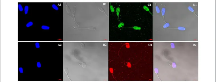 FIGURE 4 | Cellular localization of Histone 4 and Acetylated H4 in bull sperm using confocal microscopy