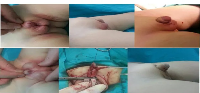 Figure 2. Patient's appearance before surgery and after 3 months.