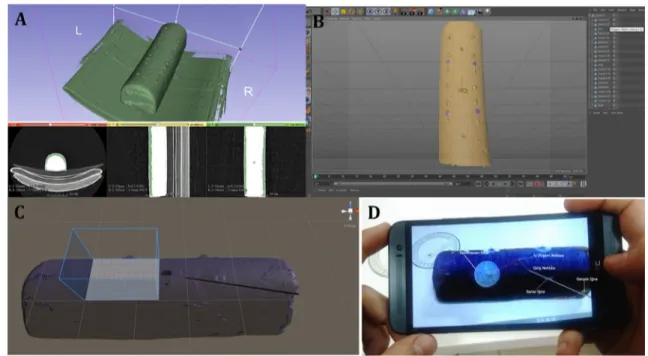 Fig. 3    First experimental model (continued). a Threshold adjustment  and 3-dimensional (3D) modeling of the gel cushion