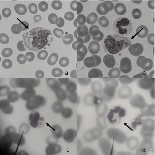 Fig. 1. Peripheral blood (×1000). Giemsa staining shows a monocytes (a, b) and granulocytes (c, d) with an  intracytoplasmic morulae (arrow).