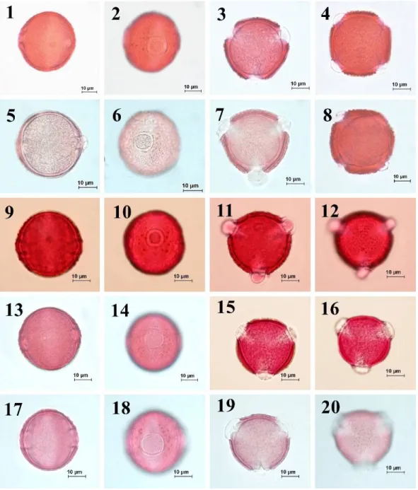 Fig.  5.  Pollen  morphology  of  the  section  Cheirolepis  observed  underlight  microscope  (LM)  according  to  Wodehouse method