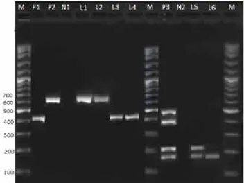 Figure 2 resumes the ERIC-PCR profiles of patho- patho-genic E. coli serotypes. ERIC-PCR genotyping  revea-led 7-18 fragments resolved per isolate