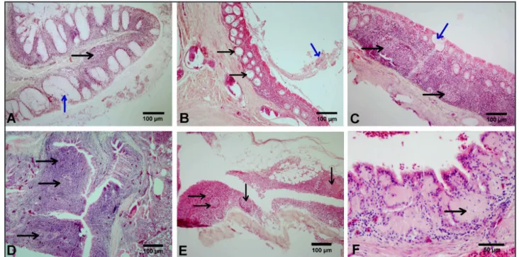 Figure 1. Histopathological changes, H&amp;E [A-E x100, Fx400]. A- Degeneration in the epithelium, lymphoid cell infiltration in the propria (+2) (black  arrow), hypertrophy of the gland (blue arrow) in nose