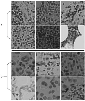 Fig. 4. Some images from our dataset. (a) normal tissue, (b) cancerous tissue. 