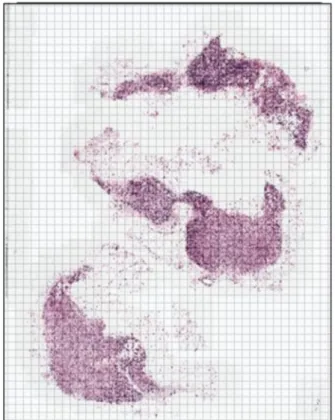 Fig. 5. Obtain a 128 × 128 pixels patch from the whole-slide image. 