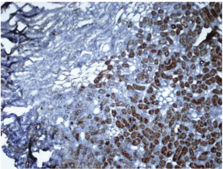 Figure 19. Zn + I/R group the medulla exhibits weak metallothionein staining. x 20. IHC.