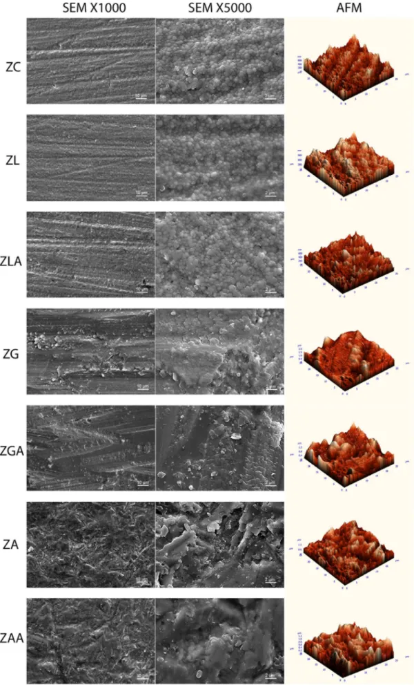 FIGURE 6  SEM and AFM images of e.max ZirCAD [Colour figure can be viewed at wileyonlinelibrary.com]