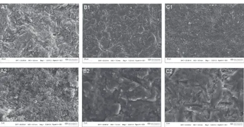 Fig. 4  Scanning electron micrographs of Y-TZP surfaces treated by air abrasion with  50 µm Al 2 O 3  at 3 bar (1,000 and 5,000× magnifications).