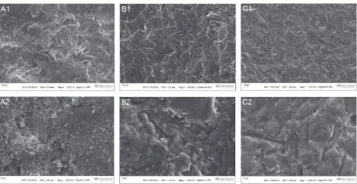 Fig. 5  Scanning electron micrographs of Y-TZP surfaces treated by air abrasion with  110 µm Al 2 O 3  at 3 bar (1,000 and 5,000× magnifications).