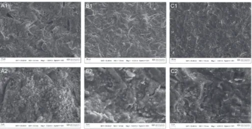Fig. 7  Scanning electron micrographs of Y-TZP surfaces treated by air abrasion with  110 µm Al 2 O 3  at 4 bar (1,000 and 5,000× magnifications).