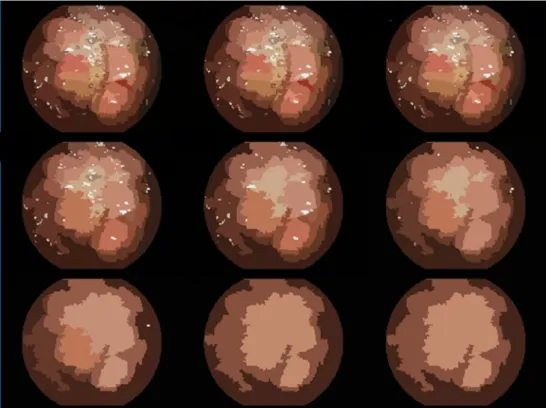 Fig. 4 Region- Growing Segmentation Steps in CAD