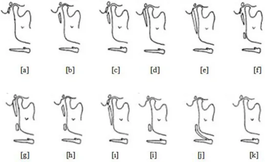 ġekil 8. Processus Styloideus Biçimleri (Omnel et al., 1998). 