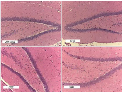 Figure 2: Toxicity side specimens of the CONTROL, SFIS, GLIV and GLIS group show the marked edema,  degenerated and vacuolized neurons localized in the hippocampus (HEx200)