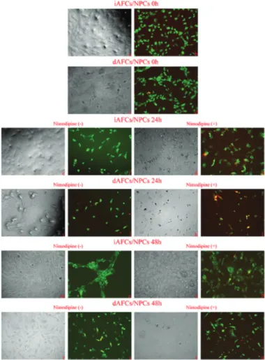 Figure 2.  Inverted  light/fluorescent  microscopy  and  acridine  orange/propidium iodide stain images.