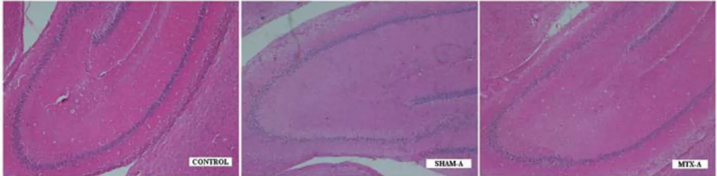 Figure 4: Histopathological examination of the CONTROL group demonstrated capillary stasis and minimal  edema with mild neuronal degeneration