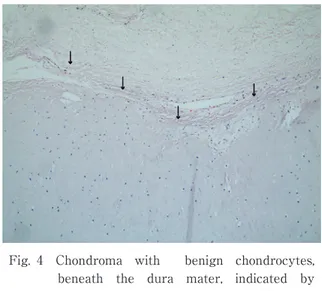 Fig. 5 Positive  immunoreactivity  of  the  chondrocytes for S-100 ( 100).