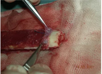 Fig. 7. Periosteum stripped and folded at the end of the ﬁbula and view of cambium layer.