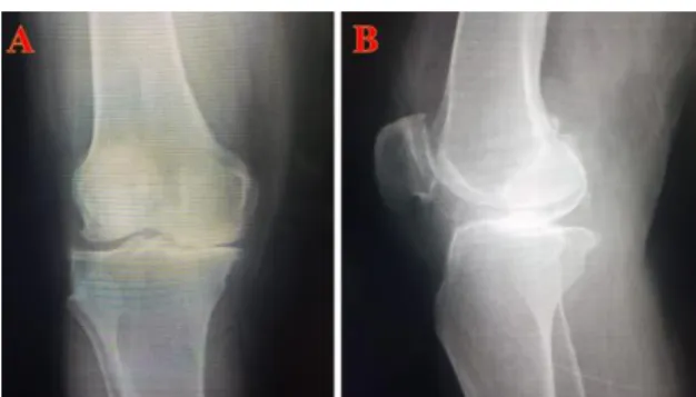Figure 1. X-ray image of one of the operated patients.  