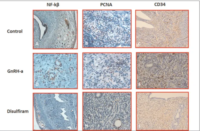 Figure  1. Representative photographs of the endometriotic implants obtained from control, GnRH-a and Disulfiram groups after treatment