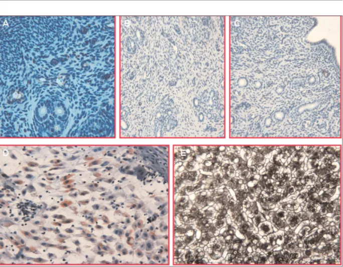 Figure 2. Negative control reactions, in which the NF-κB (A, X20), CD34 (B, X10) and PCNA (C, X10) antibody have been omitted; no specific staining has been observed