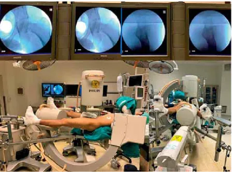 Fig. 2. Peroperative view of fracure reduction and surgery with double flouroscopy.