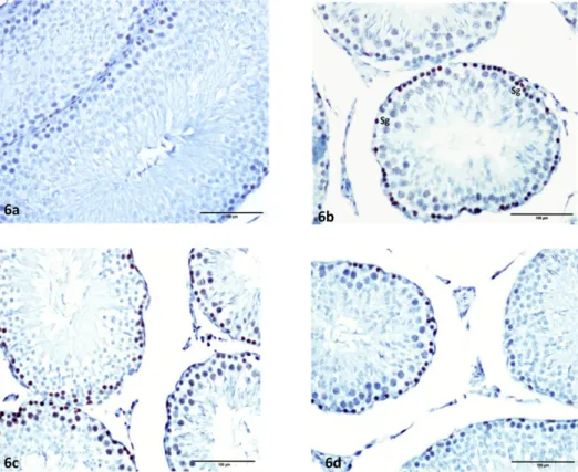 Figure 6. Ki-67 immunohistochemistry stained view of groups. Control (6a), Kiss (1) (6b), Kiss (13) (6c), and Kiss (13 + 7) (6d) groups
