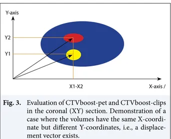 Fig. 3.  Evaluation of CTVboost-pet and CTVboost-clips  in the coronal (XY) section. Demonstration of a  case where the volumes have the same  X-coordi-nate but different Y-coordiX-coordi-nates, i.e., a  displace-ment vector exists.