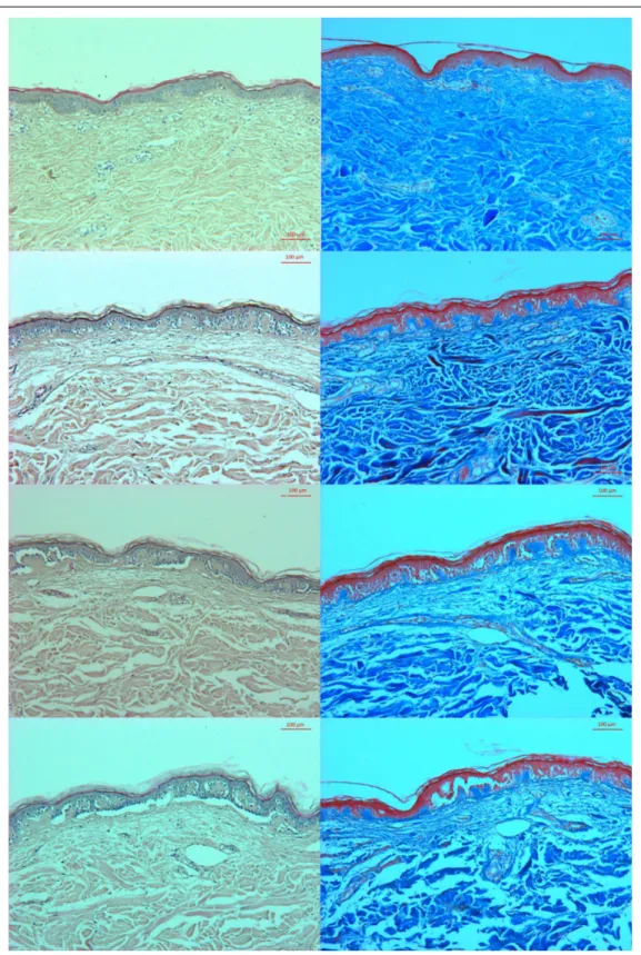 Figure 1. Microscopic characterization of skin grafts stored in saline. The left column shows the samples stained with hematoxylin and eosin, and the right column shows those stained with Masson’s trichrome