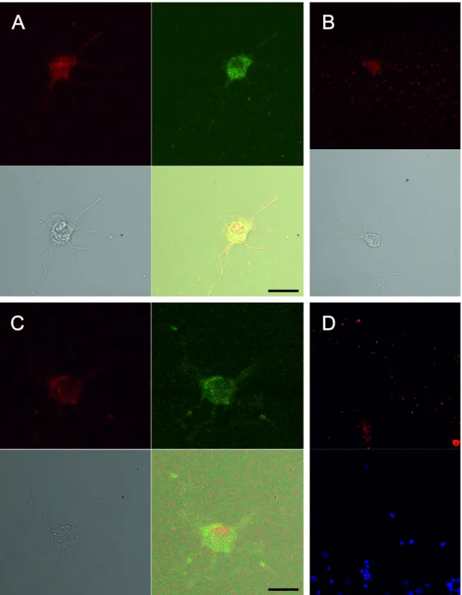 Figure 2. Immunostaining for neurotrophin receptors TrkA (A), TrkB (B), and TrkC (C). Florescent antibody stains  neuroflament 200, a neuron marker, as red, and florescent antibodies stain TrkA and TrkB receptors as green
