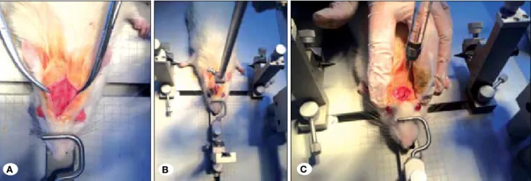 Figure 1: Revealing of Bregma (A), Determination of coordinates with stereotaxic device (B), Stem cell administration with Hamilton  syringe (C).