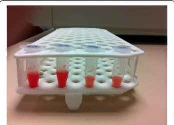 Fig. 1 Synovial fluid. Gross appearance of collected human synovial fluid from both knees of a patient