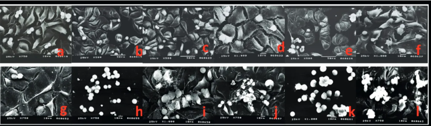 Figure 5. Scanning electron microscopy. All magnification except that of k is 750×. a–f: 24 h; g–l: 96 h; a: 24 h control group; b: resveratrol; 