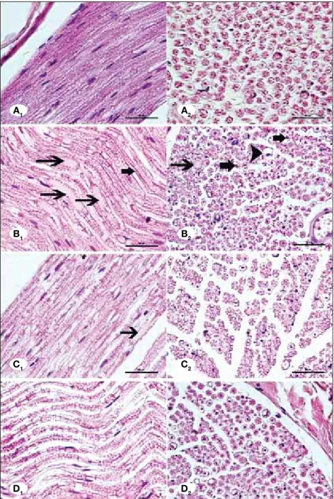 Figure 1: Control group showing normal  morphology (A1-A2). Ischemia group showing  axonal degeneration (arrows) (B1) swollen  nerve fiber with myelin loss (arrowhead) and  shrunken and darky axons (thick arrows) (B2)