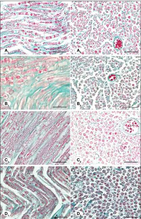 Figure 2: Control group showing normal  morphology (A1-A2). Ischemia group showing  axonal swelling and greatly high both axonal  and myelin degeneration (B1-B2)