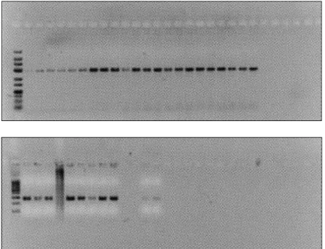 Figure 2: Agarose gel containing DNA from  33 patient tissue biopsy samples. The DNA  was isolated from tissue biopsy samples and  amplified by PCR after treatment with the AluI  restriction enzyme