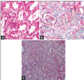 Table 3: Semi‑quantitative analysis of tubular necrosis,  interstitial fibrosis, mononuclear cell infiltration in control,  Sham, UO, and UO+PE treated rats