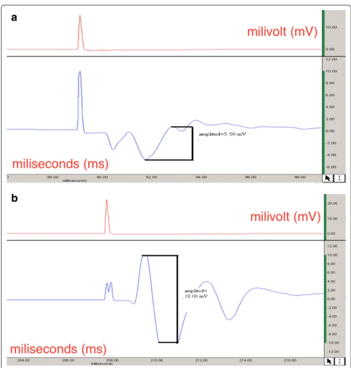 Fig. 2 Electromyograph recordings of the right limb (transection model) obtained after 9 weeks