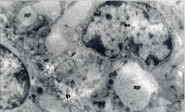 Figure 3. An electron micrograph from normal rat olfactory mucosa. BN, the nucleus of the basal cell; ap, axonal process of the olfactory neuron; lp, lamina propria; T, the bundles of tonofilaments