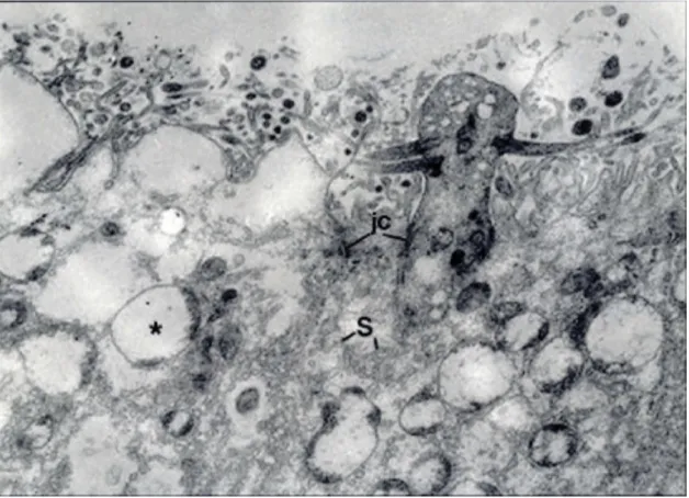 Figure 8. Electron micrographs of apical portions of the olfactory epithelia from Group III
