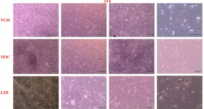 Figure 2 Invert microscopy images of chondrocytes after 36 h (the 24th hour proliferation test) of exposure to VCM, TEIC, and LZD.