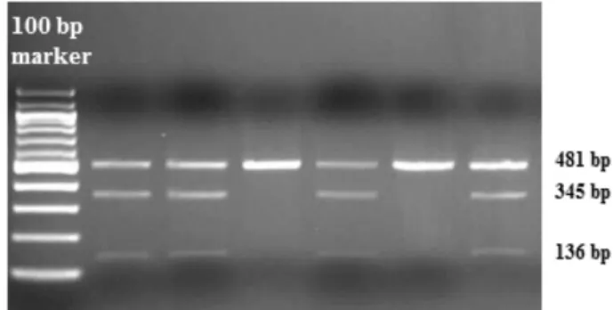 Figure 1. Genotyping for the GAS6 gene polymorphism. Representative gel showing the genotype for GAS6 834 + 7G/A