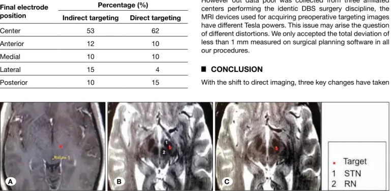 Figure 1: This figure shows 3 MRI images from the planning station (Framelink, Medtronic); A) illustrates the target on a T1 axial MR  image in a patient in group A (indirect targeting with the standard coordinates, x=12, y=-2, Z=-4, from the midcommissura