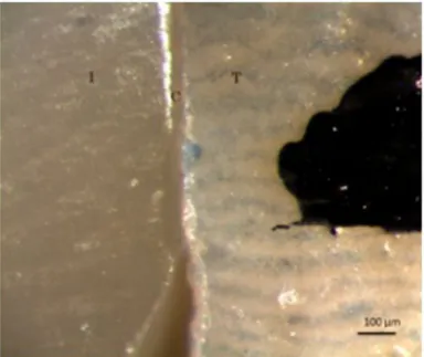 Figure 3. representative image of an inlay under optical microscopy (T: Tooth, c: cement, i: inlay).