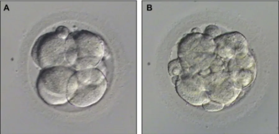 Figure 2. Embryo quality examples were given: (A) Top quality embryo (Less than 10% fragmentation and consisting of 7 –8 even- even-sized blastomeres on day 3 without any vacuolization, granulation and multinucleation; (B) Bad quality embryo (More than 10%